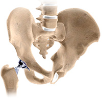 Total Hip Replacement